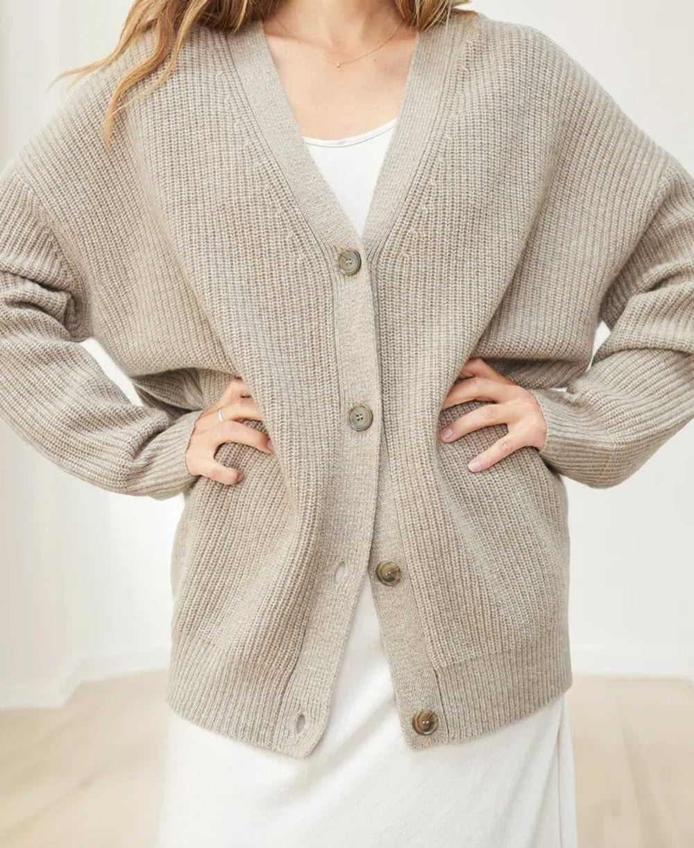 Cardigã Oversized Feminino com Decote em V e Botões